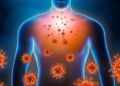 immunity