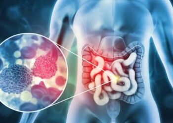 colorectal cancer