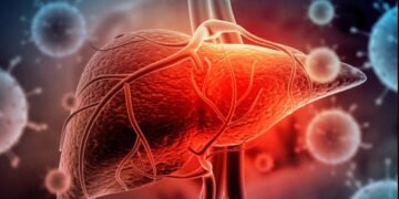 Liver detox