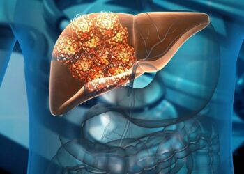 liver cases