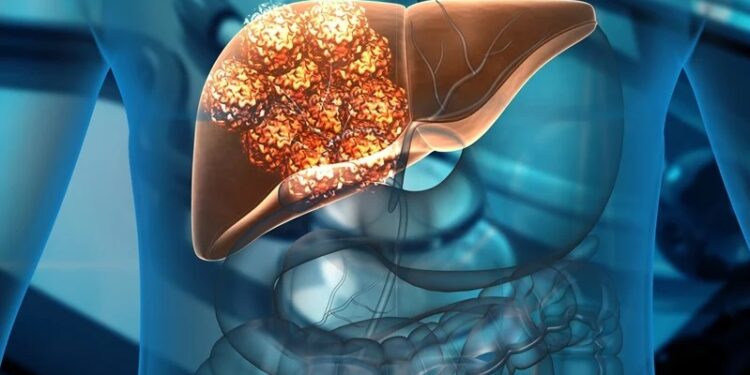 liver cases