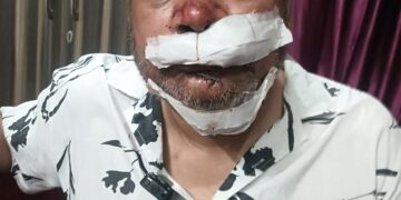 Young Man Allegedly Assaulted by Miscreants in Lucknow, One Suspect Detained by Police
