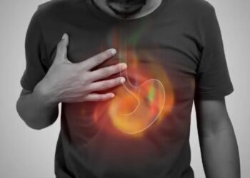 acid reflux