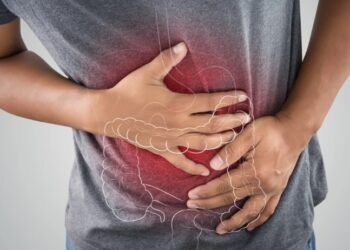 Colon Cancer