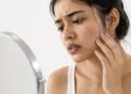 Pimples or fungal