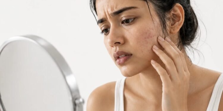Pimples or fungal